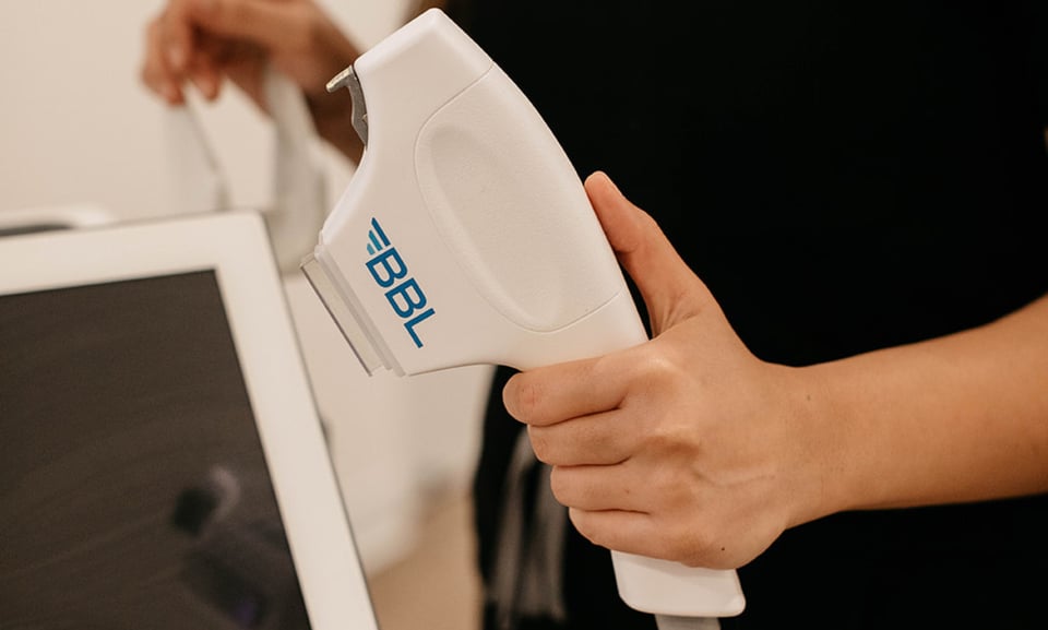 Transform Your Skin with BBL Photofacial at Vitalyc Medspa