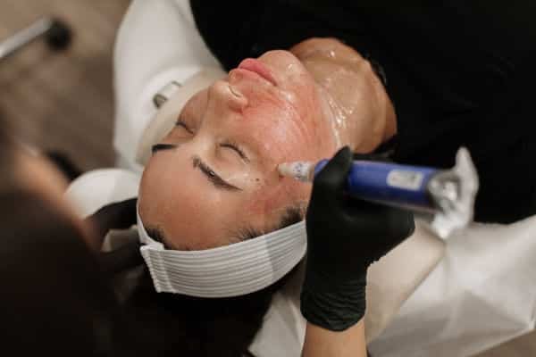 Face treatment at Vitalyc MedSpa.