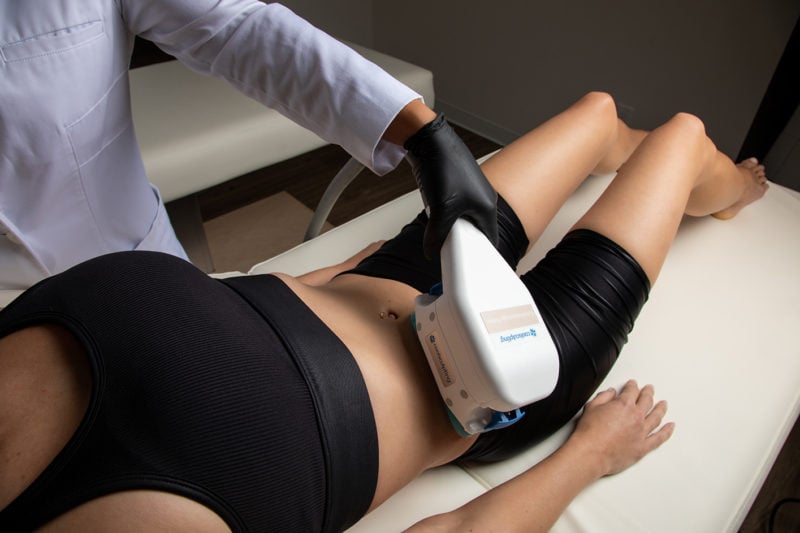 How to Lose Belly Fat Through CoolSculpting